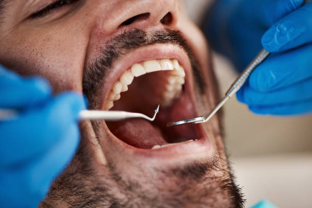 Best Emergency Treatment for Dental Infections or Abscesses in Wellsboro, PA