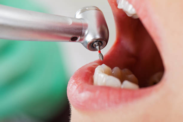 Best Emergency Tooth Extraction in Wellsboro, PA